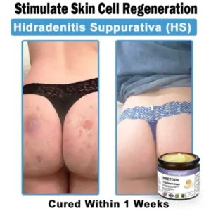 Coastglee® Bee Toxin Skin Treatment Cream