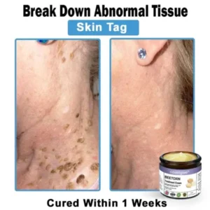 Coastglee® Bee Toxin Skin Treatment Cream