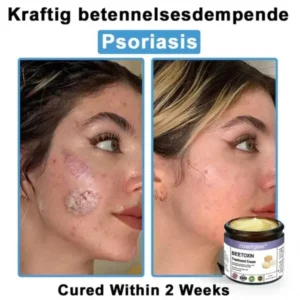 Coastglee® Bee Toxin Skin Treatment Cream