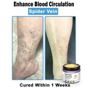 Coastglee® Bee Toxin Skin Treatment Cream
