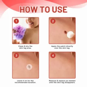 Coastglee® MicroDart Skin Tag Remover Patch