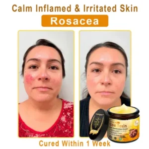 Coastglee® Skin Treatment Cream