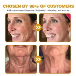 Coastglee® Skin Treatment Cream
