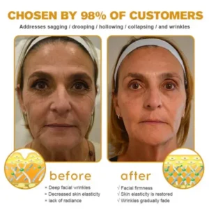 Coastglee® Skin Treatment Cream