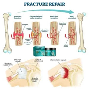 Coastglee™Shark Cartilage Joint Relief Cream
